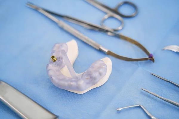 Model zębów z metalowym implantem i narzędziami dentystycznymi — Zdjęcie stockowe