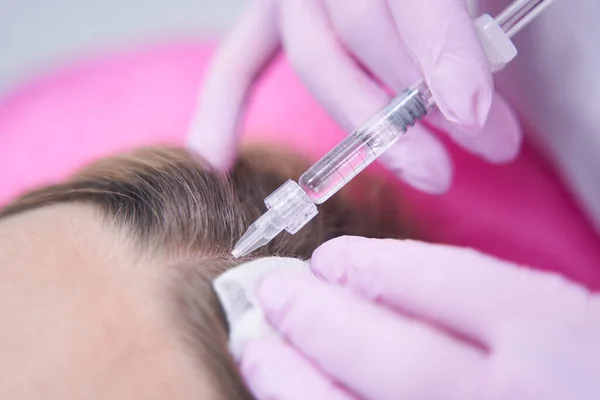 Tricólogo que trata al paciente por pérdida de cabello con inyecciones — Foto de Stock