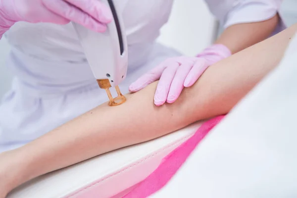 Dermatologista experiente realizando procedimento de depilação a laser — Fotografia de Stock