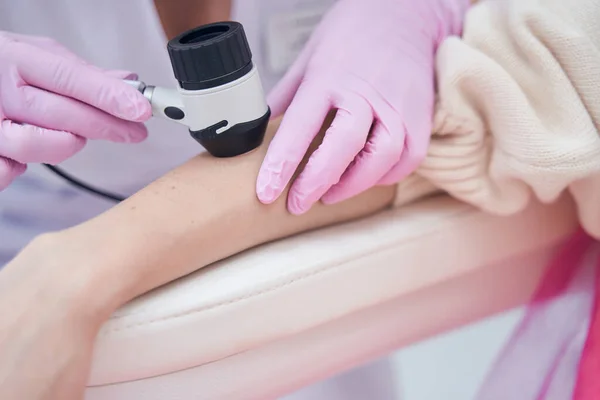 Doktor v nitrilových rukavicích kontroluje pokožku pacienta s dermoskopem — Stock fotografie