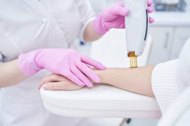 Kozmetik uzmanı lazer cihazıyla kadın kolundaki kılları alıyor.