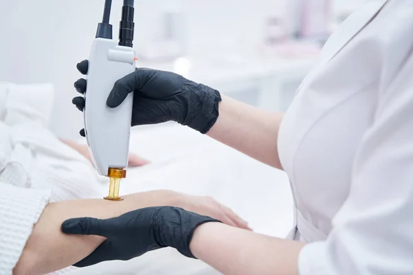 Schoonheidsspecialiste handen uitvoeren laser ontharing procedure — Stockfoto