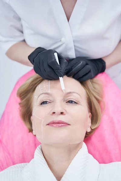 В косметологической клинике на лице женщины рисуют метки — стоковое фото