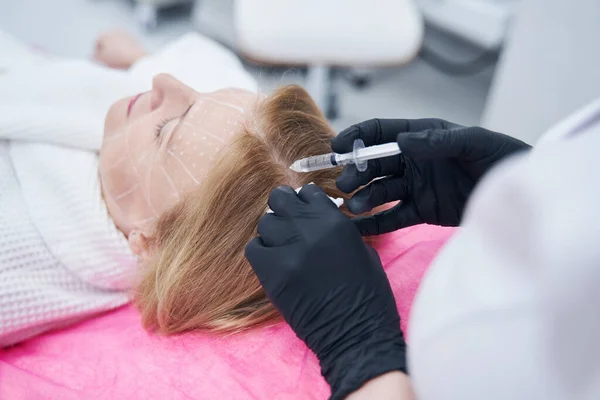 Donna che riceve l'iniezione nel cuoio capelluto durante il trattamento di mesoterapia — Foto Stock