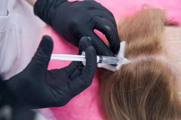 Dokter handen doen injectie in vrouw hoofdhuid in beauty center — Stockfoto