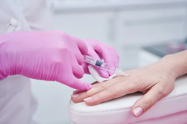 Close up de cosmetologista fazendo pontos na mão — Fotografia de Stock