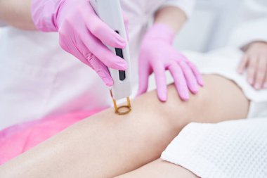 Klinikte İskenderiye tüyü temizleme lazeri kullanan kadın güzellik uzmanı.