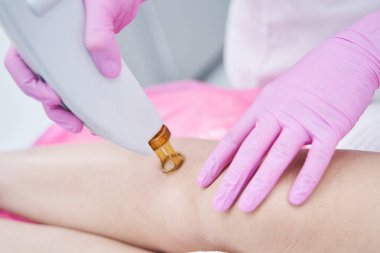 Güzellik uzmanı kozmetoloji kliniğinde saç temizleme lazeri kullanıyor.