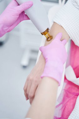 Kozmetik uzmanı, İskenderiye lazeriyle kadın kolundaki kılları alıyor.