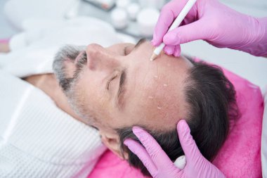 Yetişkin sakallı adam alnına estetik yaptırmadan önce hazırlanıyor.