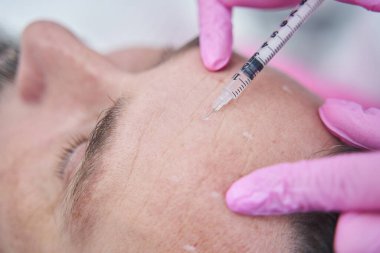 Alnında güzellik enjeksiyonu sırasında gözleri kapalı yatan beyaz bir adam.