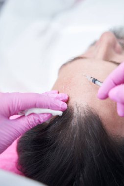 Yetişkin bir adam alnına estetik iğne vuruluyor.