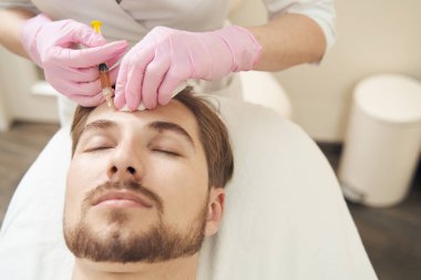 Güzellik kliniği çalışanı erkek kafasına cilt yenilenmesi için şırıngadan plazma enjekte ediyor.
