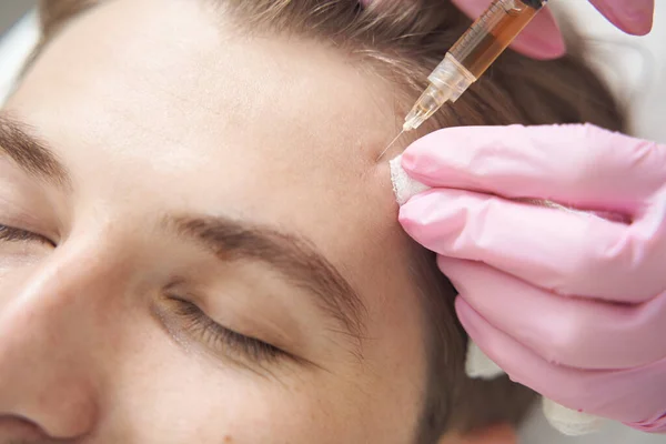 美容面部更新过程中用等离子植入人头皮肤的注射器的特写照片 — 图库照片