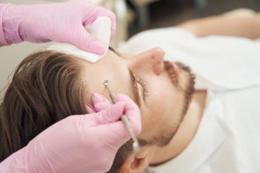 Kozmetik uzmanı, tek kaşık enstrümanı ve bezi olan genç bir adamın alnındaki gözenekleri çıkarıyor.