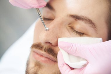 Tek kaşıkla derin gözenek temizleme işlemi sırasında insan burnuna aşırı yakın çekim.