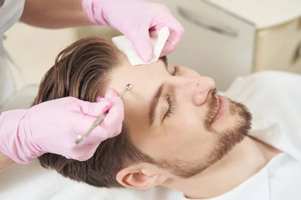Kozmetikus Eltávolítja Homlok Bőrét Ember Szennyeződések Segítségével Uno Kanál Szövet — Stock Fotó