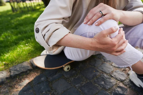 Χέρια Της Νεαρής Γυναίκας Σφιγμένο Γόνατο Στο Δεξί Της Πόδι — Φωτογραφία Αρχείου