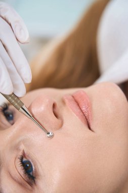 Tıbbi ve kozmetoloji merkezinde tek kaşıkla burun üzerindeki sivilcelerin mekanik olarak alınması.