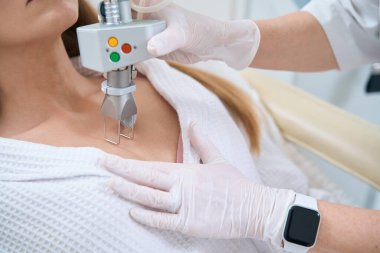 Bir kozmetoloji kliniğindeki dekolte bölgenin derisindeki neoplazmaların lazerle alınması prosedürü.