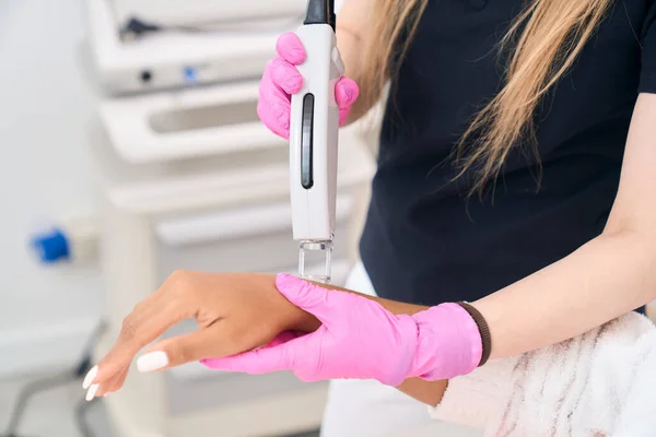 Highly effective, painless procedure for laser hair removal of the hands in a modern aesthetic medicine center