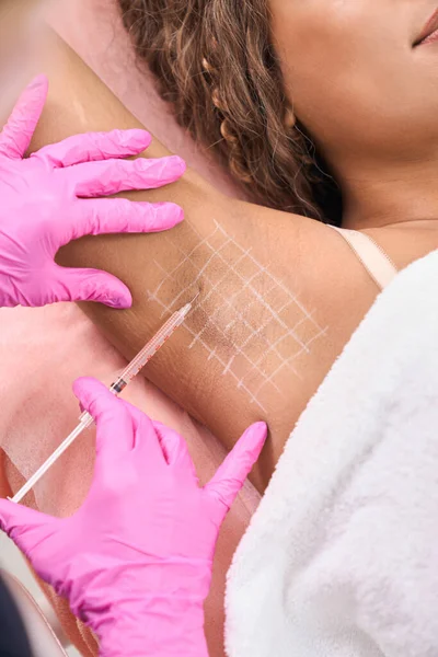 Female Patient Hyperhidrosis Problem Receiving Botulinum Toxin Injections Armpits Cosmetology — Foto Stock