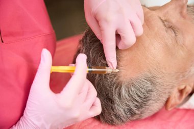 Female hands of a cosmetologist injecting a beauty injection into the forehead near hair growth