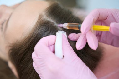 Cropped photo of head injection process for better hair growth. Procedures in a beauty salon