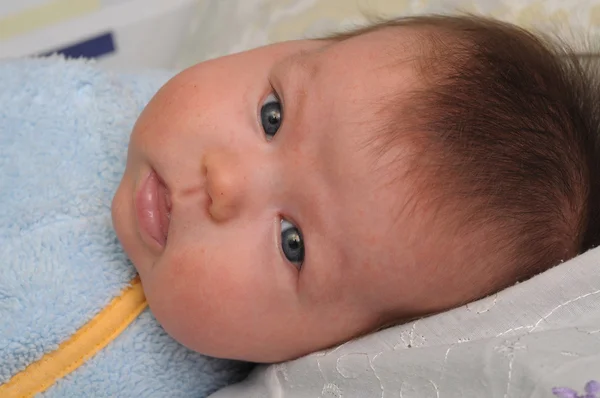 Newborn baby with allergic — Stock Photo, Image