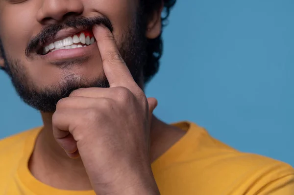 Dospělý muž ukazující své periodontální onemocnění před kamerou — Stock fotografie