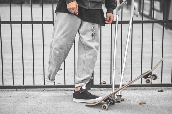 Disabled guys foot stepping on skateboard — Φωτογραφία Αρχείου