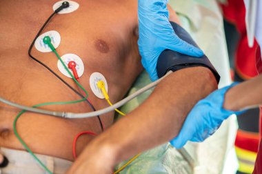 ECG elektrotları sırtüstü uzanmış yatarken bir doktor koluna kan basıncı kelepçesi takıyor.