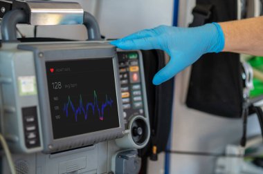 ECG monitörüne dokunan azot eldivenli bir sağlık çalışanının kesilmiş fotoğrafı.