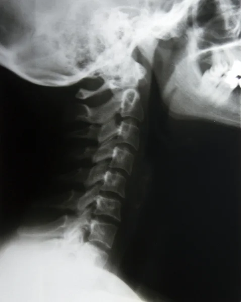 X-ray krk — Stock fotografie
