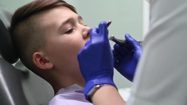 Dişçi Çocuğun Dişlerini Özel Bir Aletle Temizler — Stok video