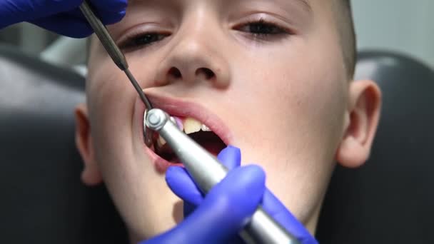 Diş Hekimi Çocuğun Dişlerini Özel Bir Aletle Temizler — Stok video