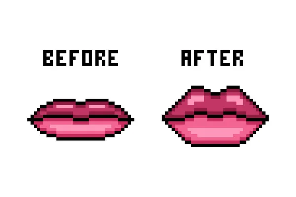 Pixel Art Natürlichen Dünnen Füllstoff Injektion Lippen Vor Und Nach — Stockvektor