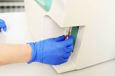 Bir laboratuvar asistanı modern bir mikrobiyoloji kliniğinde kan örneğini inceler..