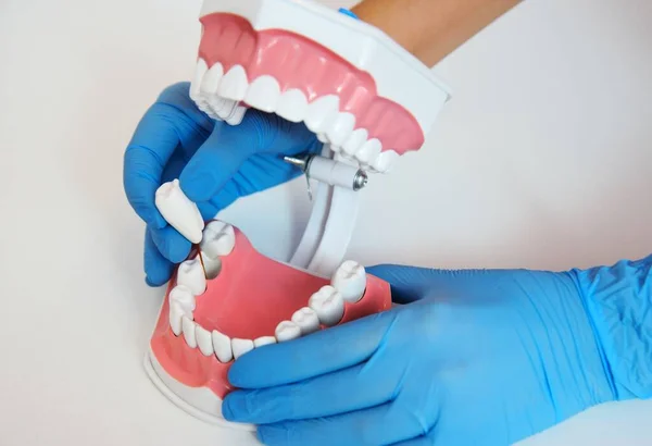 Mandíbula artificial en primer plano en las manos de un dentista en guantes de goma sobre un fondo blanco. — Foto de Stock
