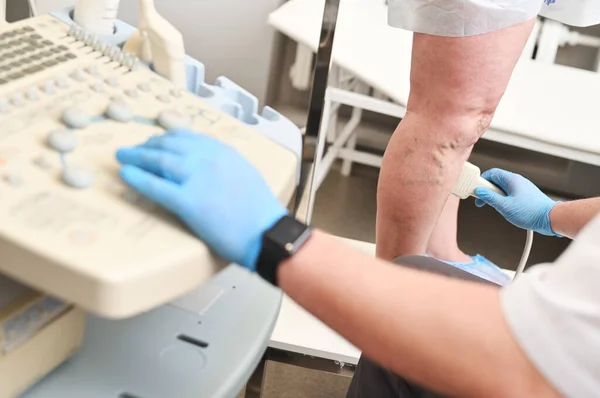 Phlebologe führt Ultraschall der Venen eines Patienten mit Krampfadern durch. — Stockfoto