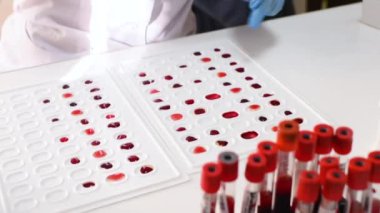 Kauçuk eldivenli araştırmacı bakteriyolojik ya da genetik laboratuvar kan testi yapar