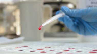 Laboratuvar çalışanı kan grubu ve Rh faktörü tanımlaması için cuvette tutuyor.