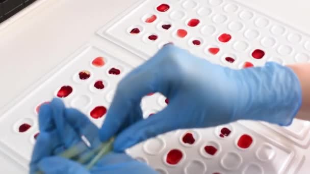 ゴム手袋の研究者の細菌学的または遺伝学的研究室は血液検査を行い — ストック動画