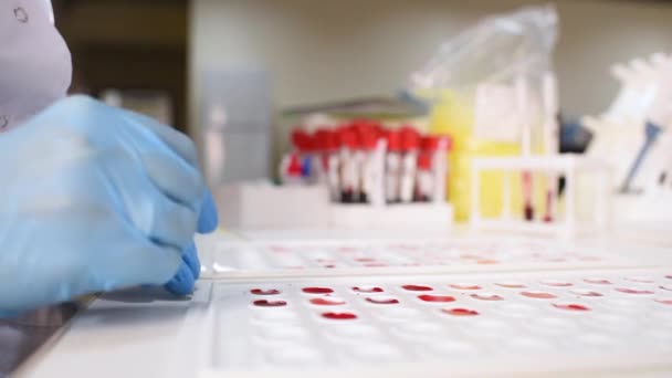 Researcher bacteriological or genetic laboratory in rubber gloves makes a blood test — Stock Video