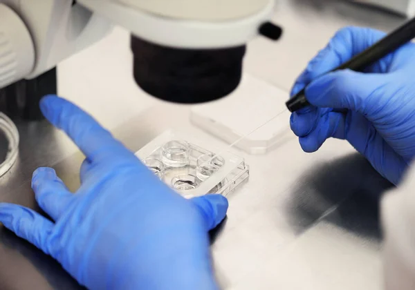 Proceso de inseminación artificial de un óvulo en una clínica de FIV. — Foto de Stock