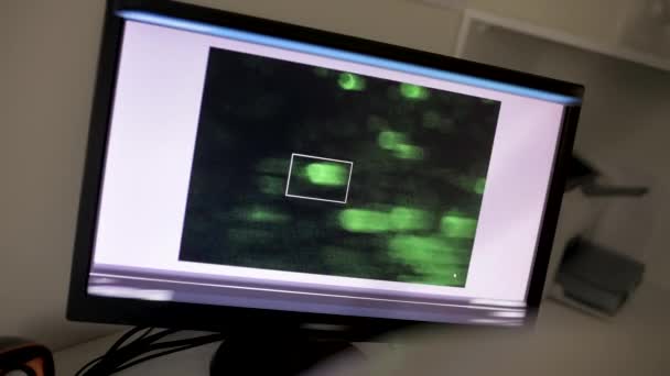 Πράσινα μόρια ενός ιού ή βακτήρια κάτω από ένα σύγχρονο ηλεκτρονικό μικροσκόπιο κοντά σε μια οθόνη — Αρχείο Βίντεο