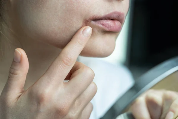 Menina aplicando bálsamo labial com o dedo para evitar secura e chapeamento na estação fria, olhando para o espelho — Fotografia de Stock