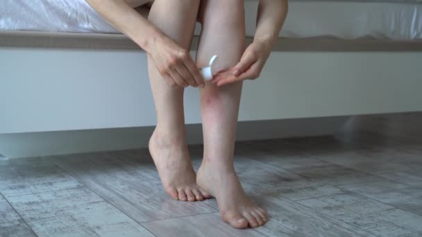 妇女坐在床上 在肿胀的皮肤腿上涂上蚊虫叮咬的乳膏或香膏 有过敏反应 瘙痒等症状 个人对昆虫叮咬的抵抗力 — 图库视频影像