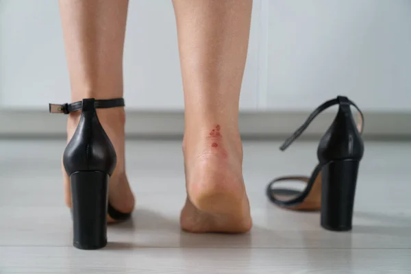 Woman Feet Pain Wearing High Heeled Shoes Walking Closeup Back — Stockfoto