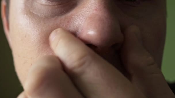 Um nariz dolorido depois de um nariz escorrendo close-up. pele rachada no nariz. pele dolorida — Vídeo de Stock